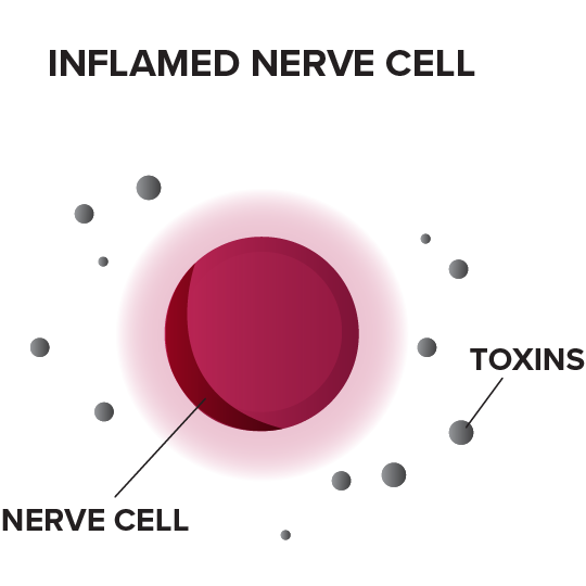 MOA inflamed nerve cell