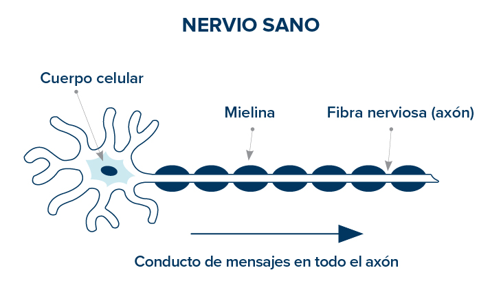 nervio sano