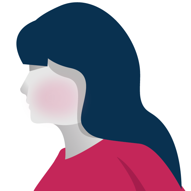 síntoma de enrojecimiento